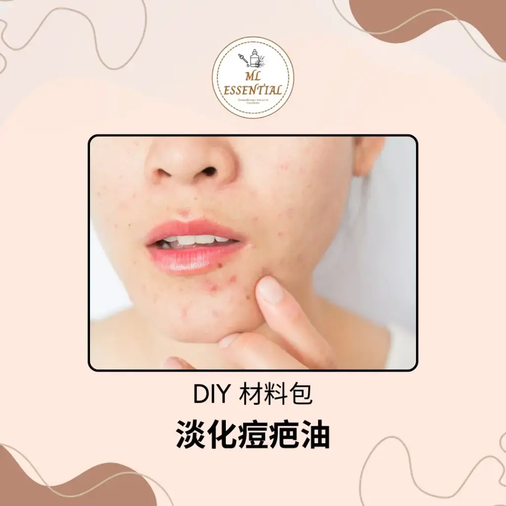 淡化痘疤油 DIY 材料包 @ Acne Scar Lightening Oil DIY Material Kit