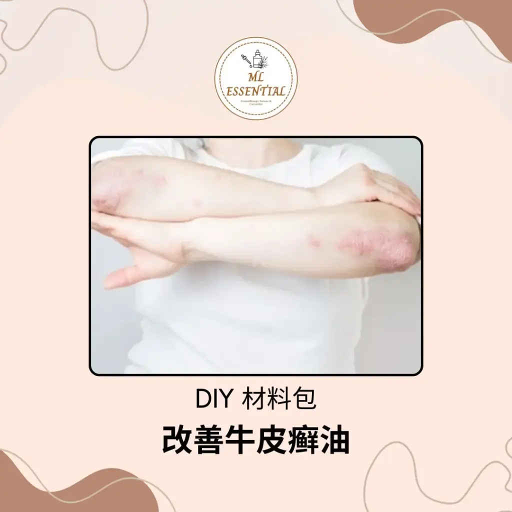 改善牛皮癣油 DIY 材料包 @ Psoriasis Treatment Oil DIY Material Kit
