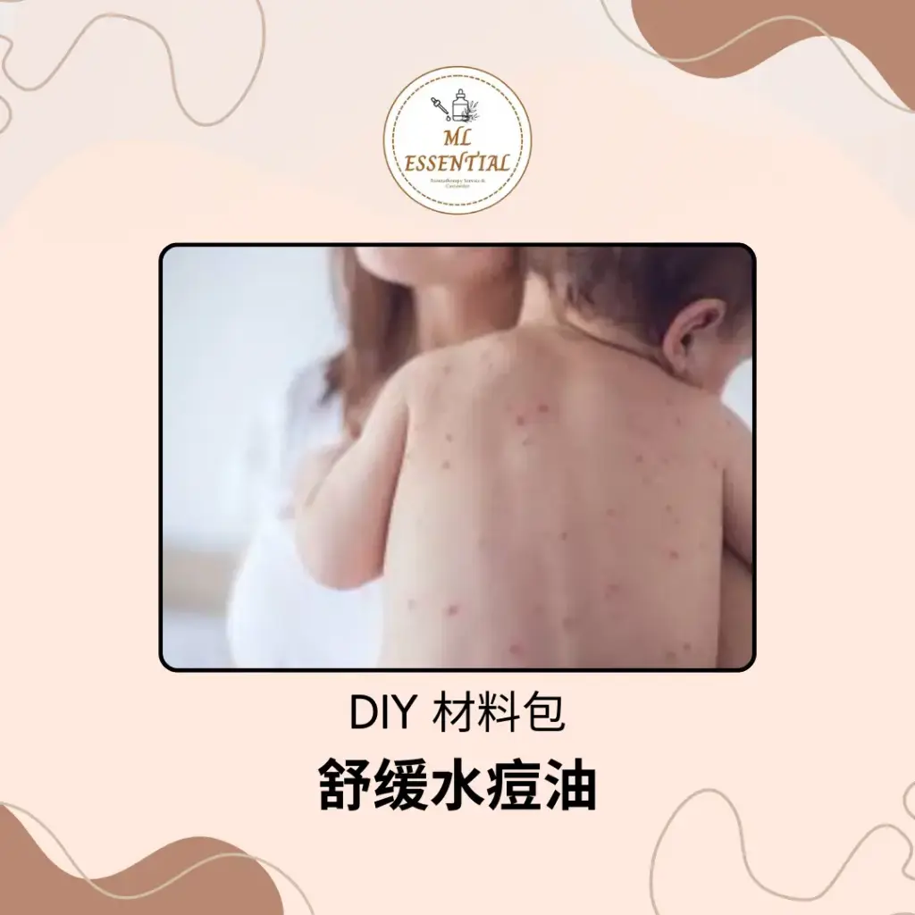 舒缓水痘油 DIY 材料包