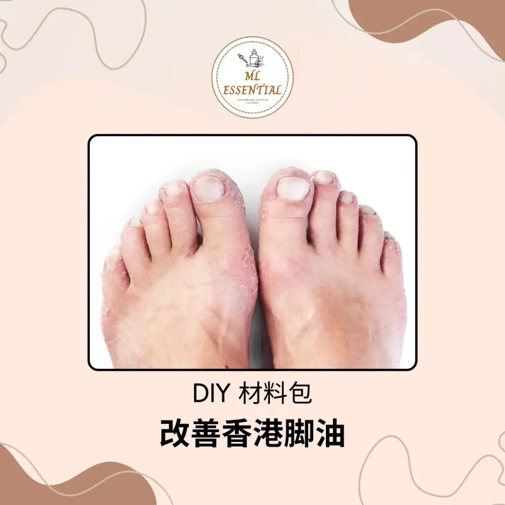 改善香港脚油 DIY 材料包 @ Athlete’s Foot Treatment Oil DIY Material Kit