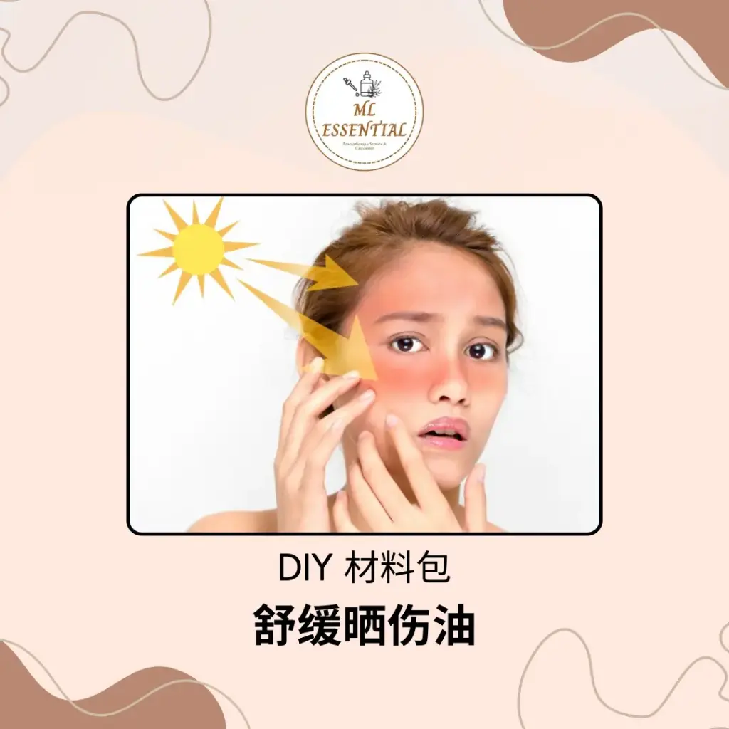 舒缓晒伤油 DIY 材料包 @ Sunburn Relief Oil DIY Material Kit