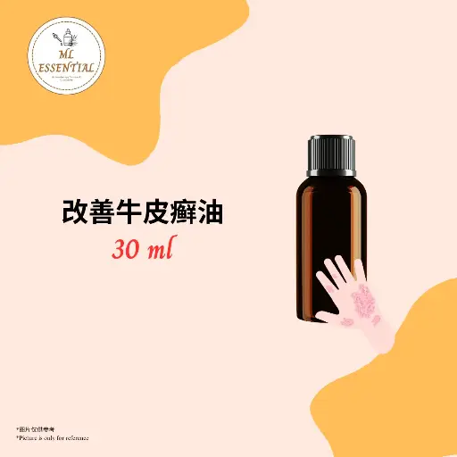 改善牛皮癣油 30ml