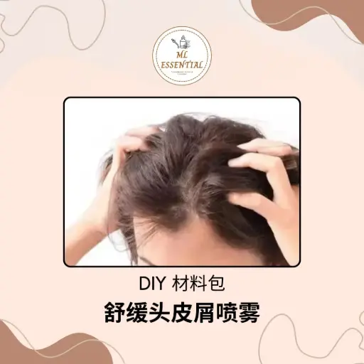 舒缓头皮屑喷雾 DIY 材料包 @ Soothing Dandruff Hair Spray DIY Material Kit
