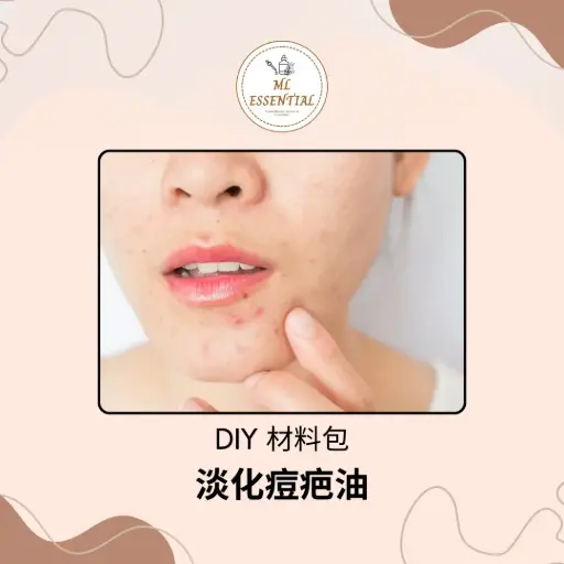 淡化痘疤油 DIY 材料包 @ Acne Scar Lightening Oil DIY Material Kit