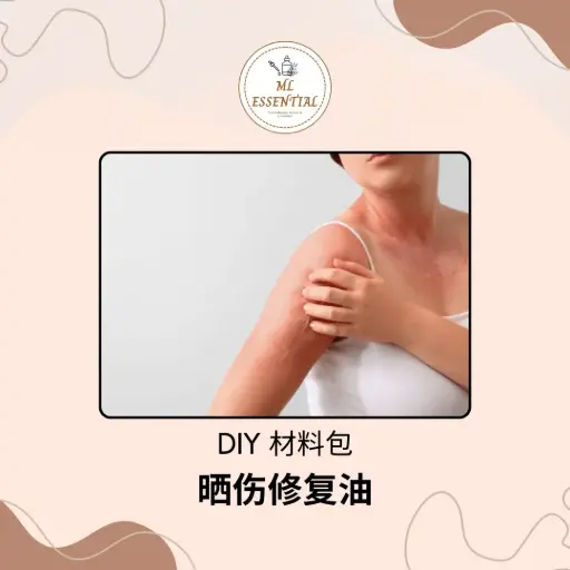 晒伤修复油 DIY 材料包 @ Sunburn Relief Oil DIY Material Kit