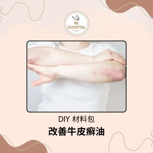 改善牛皮癣油 DIY 材料包 @ Psoriasis Treatment Oil DIY Material Kit