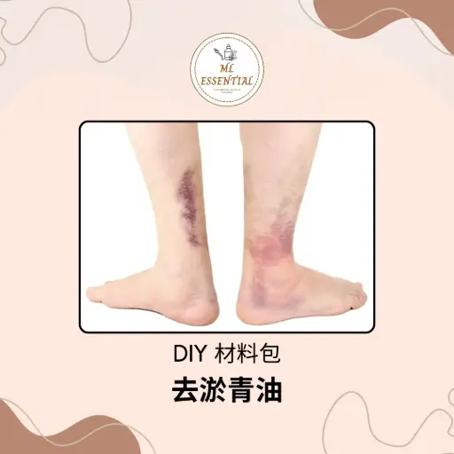 去淤青油 DIY 材料包