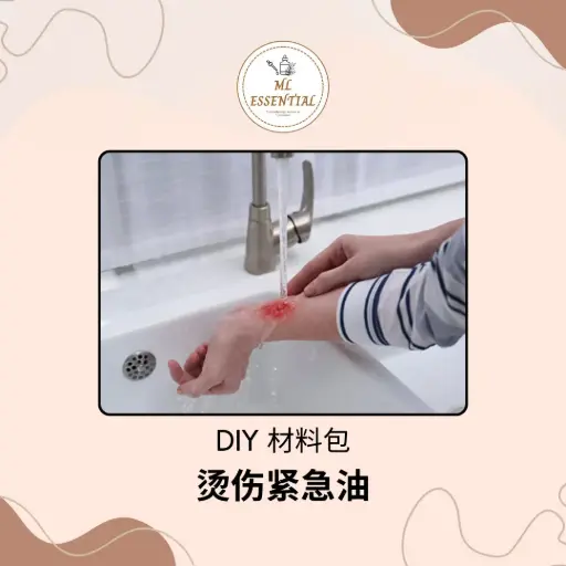 烫伤紧急油 DIY 材料包 @ Burn Emergency Oil DIY Material Kit