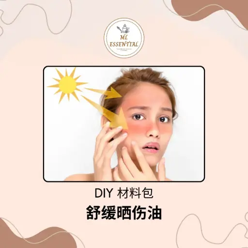 舒缓晒伤油 DIY 材料包 @ Sunburn Relief Oil DIY Material Kit